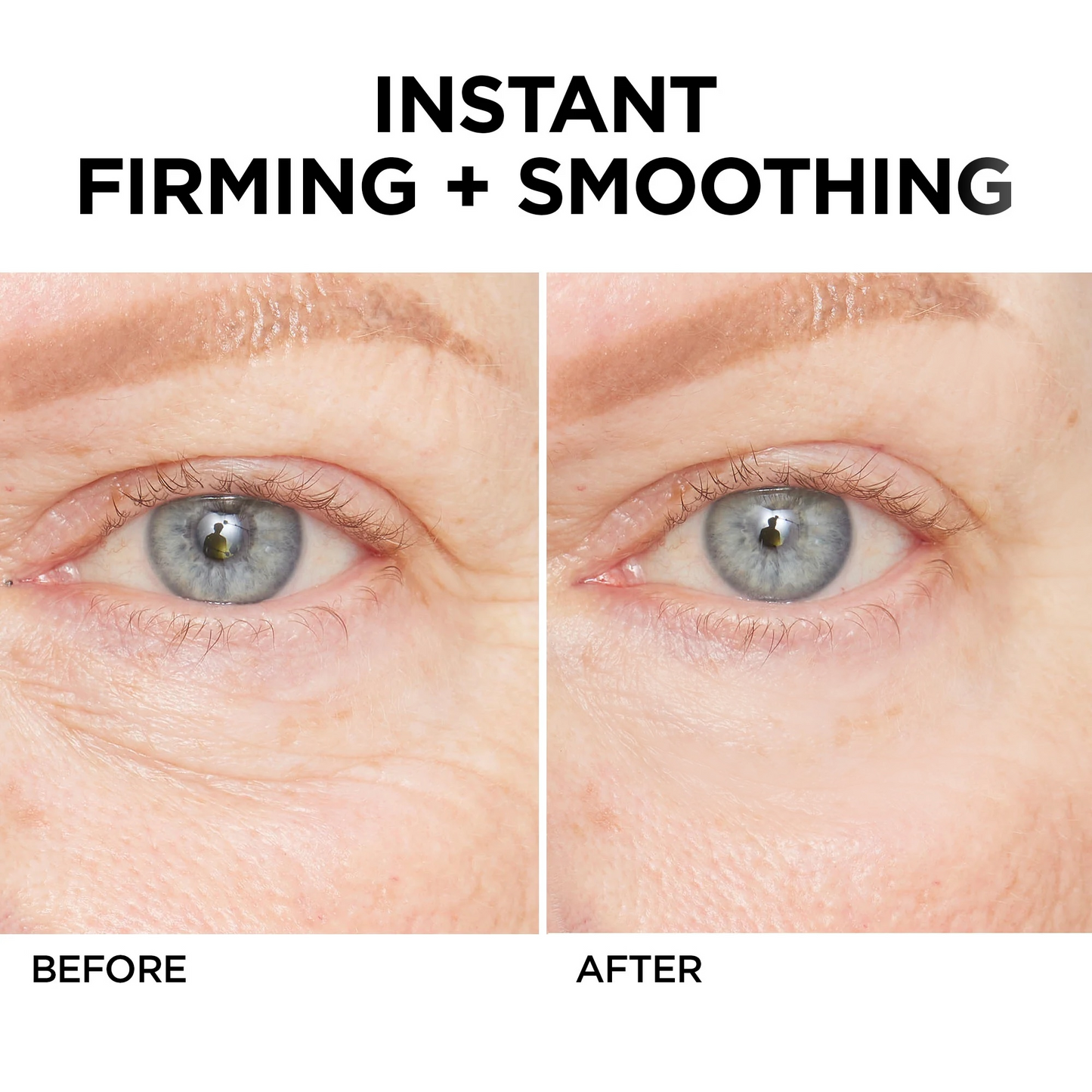 💥Lovilds™🔥Instant Wrinkle Eye Tightener cream