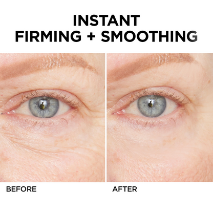 💥Lovilds™🔥Instant Wrinkle Eye Tightener cream
