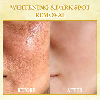 🌿💧𝐋𝐚𝐬𝐭 𝐃𝐚𝐲 𝐃𝐢𝐬𝐜𝐨𝐮𝐧𝐭: 𝟕𝟎% 𝐎𝐅𝐅 QIAWI ® SkinFirming Rejuvenating Oil