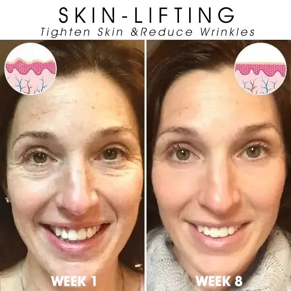 🌿💧𝐋𝐚𝐬𝐭 𝐃𝐚𝐲 𝐃𝐢𝐬𝐜𝐨𝐮𝐧𝐭: 𝟕𝟎% 𝐎𝐅𝐅 QIAWI ® SkinFirming Rejuvenating Oil