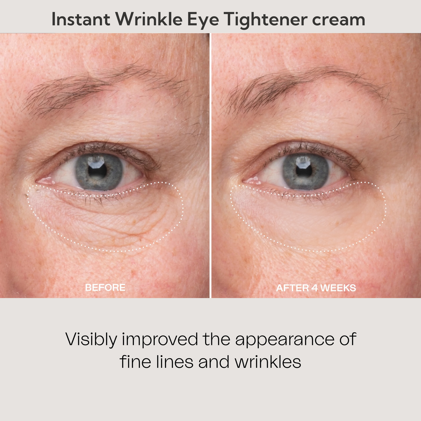 💥Lovilds™🔥Instant Wrinkle Eye Tightener cream