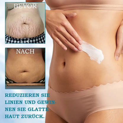 🎁Last Day Discount 87% 𝐎𝐅𝐅🌸LOVILDS® 𝐀𝐝𝐯𝐚𝐧𝐜𝐞𝐝 𝐅𝐢𝐫𝐦𝐢𝐧𝐠 & 𝐖𝐫𝐢𝐧𝐤𝐥𝐞-𝐑𝐞𝐝𝐮𝐜𝐢𝐧𝐠 𝐂𝐫𝐞𝐚𝐦: Restore Skin Elasticity⭐