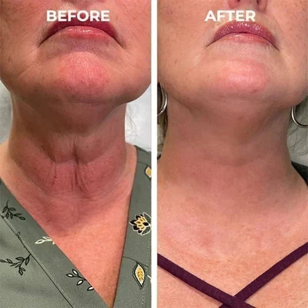 🌿💧𝐋𝐚𝐬𝐭 𝐃𝐚𝐲 𝐃𝐢𝐬𝐜𝐨𝐮𝐧𝐭: 𝟕𝟎% 𝐎𝐅𝐅 QIAWI ® SkinFirming Rejuvenating Oil