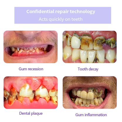 BBOJI™ Teeth Restoration Mineral Powder