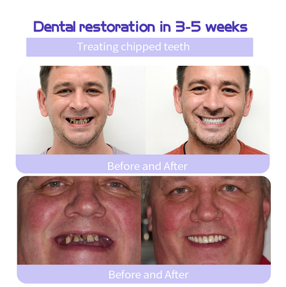 BBOJI™ Teeth Restoration Mineral Powder