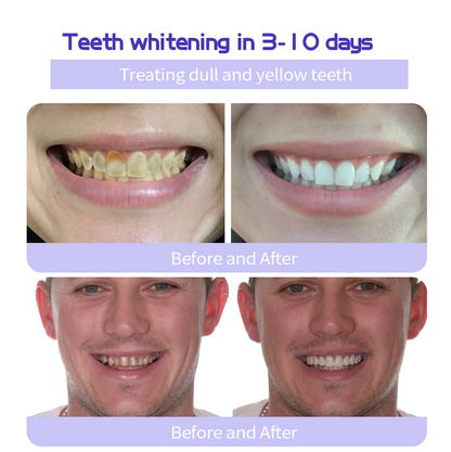 BBOJI™ Teeth Restoration Mineral Powder