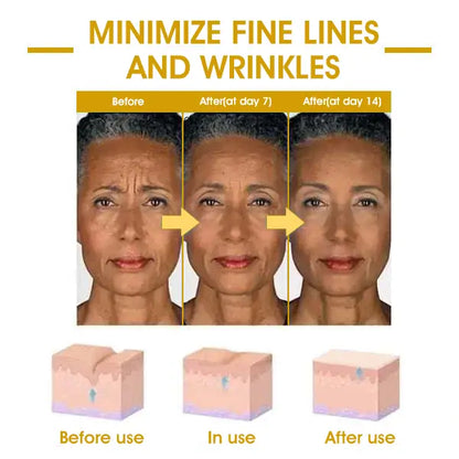 🌿💧𝐋𝐚𝐬𝐭 𝐃𝐚𝐲 𝐃𝐢𝐬𝐜𝐨𝐮𝐧𝐭: 𝟕𝟎% 𝐎𝐅𝐅 QIAWI ® SkinFirming Rejuvenating Oil
