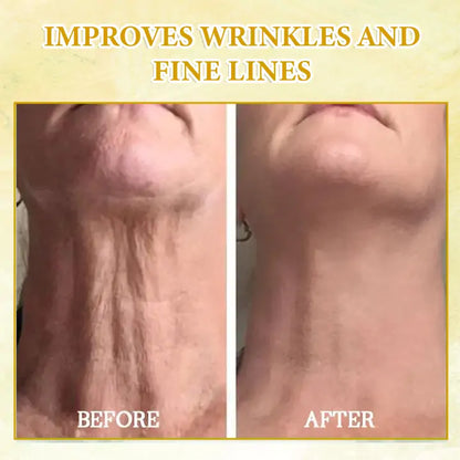 🌿💧𝐋𝐚𝐬𝐭 𝐃𝐚𝐲 𝐃𝐢𝐬𝐜𝐨𝐮𝐧𝐭: 𝟕𝟎% 𝐎𝐅𝐅 QIAWI ® SkinFirming Rejuvenating Oil