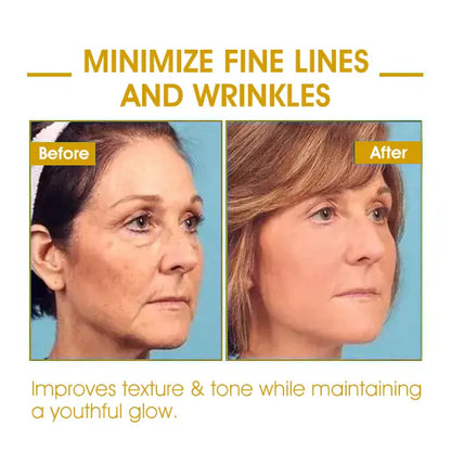 🌿💧𝐋𝐚𝐬𝐭 𝐃𝐚𝐲 𝐃𝐢𝐬𝐜𝐨𝐮𝐧𝐭: 𝟕𝟎% 𝐎𝐅𝐅 QIAWI ® SkinFirming Rejuvenating Oil