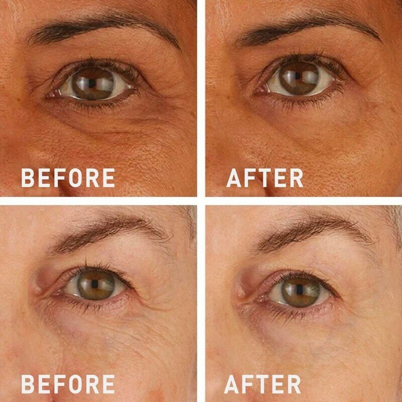 💥Lovilds™🔥Instant Wrinkle Eye Tightener cream