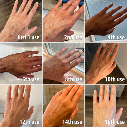 (🔥LAST DAY SALE-80% OFF)-Fast Dark Spot Remover-NESLEMY  Turmeric Spot Repair Serum