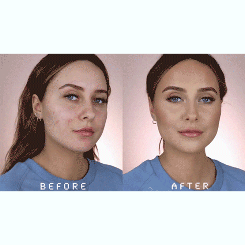LOVILDS™ Botulin Bee Poison Wrinkle Removal Cream