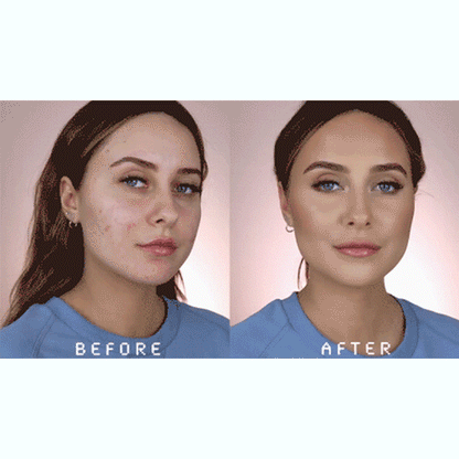LOVILDS™ Botulin Bee Poison Wrinkle Removal Cream