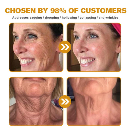 LOVILDS™ Botulin Bee Poison Wrinkle Removal Cream