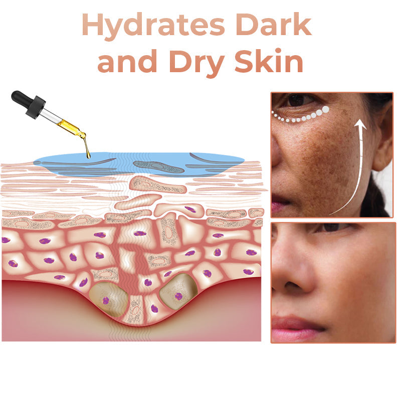 (🔥LAST DAY SALE-80% OFF)-Fast Dark Spot Remover-NESLEMY  Turmeric Spot Repair Serum