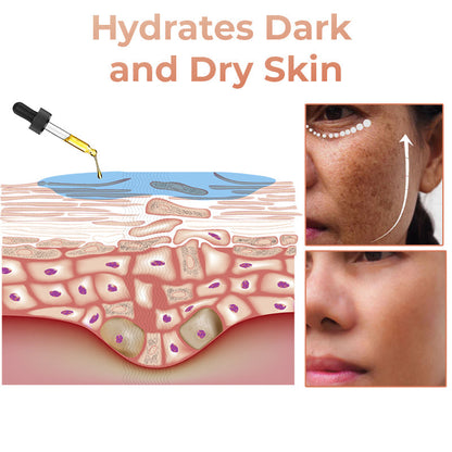 (🔥LAST DAY SALE-80% OFF)-Fast Dark Spot Remover-NESLEMY  Turmeric Spot Repair Serum